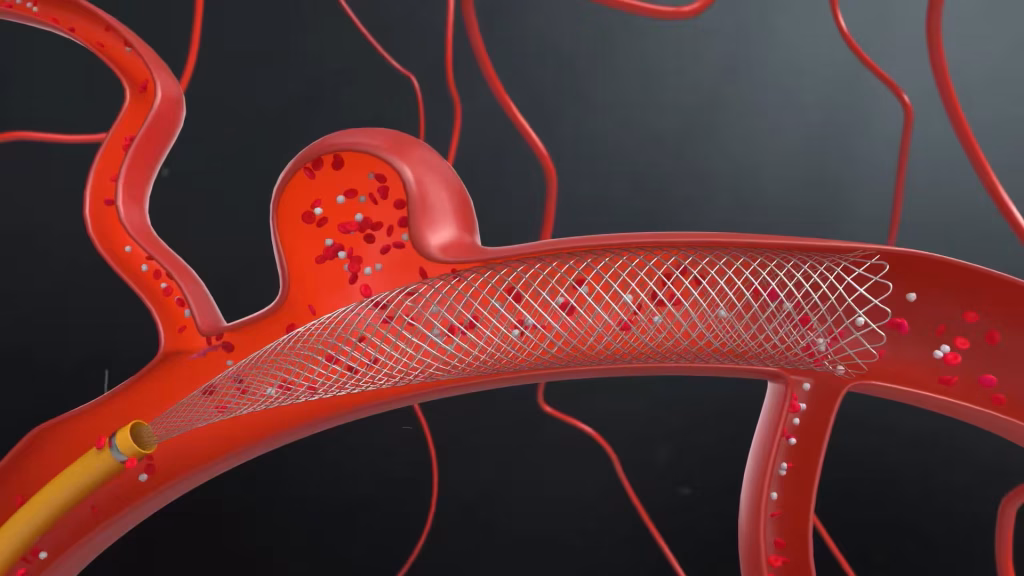 Camouflage-Coating-Medical-Device-Explainer-Video-Case-Study-Conclusion